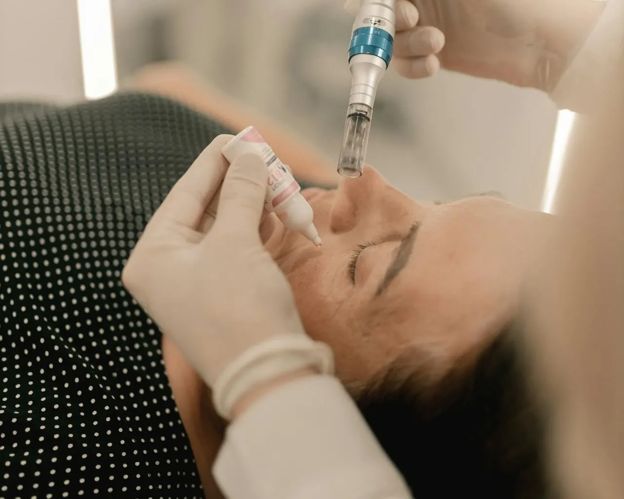 Microneedling a radiofrequenza frazionata — trattamento professionale per ringiovanimento di viso e collo